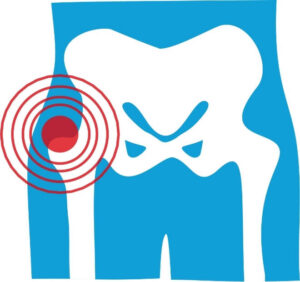 Illustration of hip joint with highlighted pain area representing common conditions requiring hip pain treatment