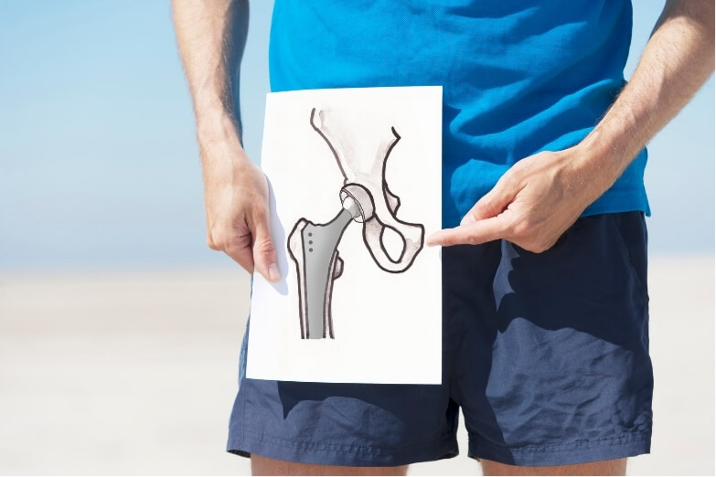 Person holding hip joint diagram highlighting causes of hip pain treatment approaches