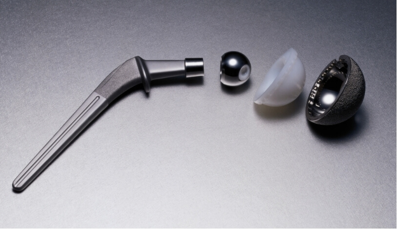 Components of a hip prosthesis used in bilateral hip replacement physiotherapy and rehabilitation treatment