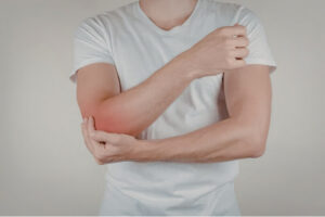 Person holding a painful elbow, illustrating symptoms of elbow tendinopathy.